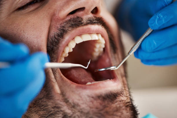 Best Emergency Dental Care for Abscessed Tooth in Island Walk, FL